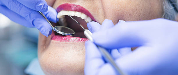 Best Walk-In Emergency Dental Services in Barberton, OH
